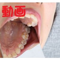 Teeth of ChiakiMovie
