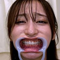 【歯フェチ】足立友梨さんの歯を観察しました！ 