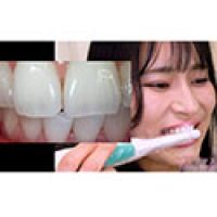 【歯フェチ】特別企画! 岩沢香代さんの歯・口内・喉奥を歯科用カメラで観察