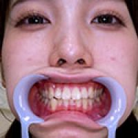 【歯フェチ】花里アカリちゃんの歯を観察しました!