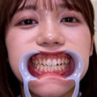 【歯フェチ】小野寺舞ちゃんの歯を観察しました！ 