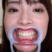 【歯フェチ】橘内ひなたさんの歯を観察しました！ 