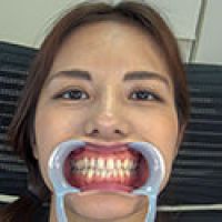【歯フェチ】武藤あやかさんの歯を観察しました！