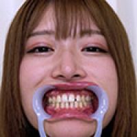 【歯フェチ】葉月ひなちゃんの歯を観察しました!