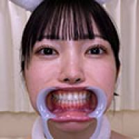 【歯フェチ】道久てんちゃんの歯を観察しました!