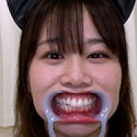 【歯フェチ】北村海智ちゃんの歯を観察しました!