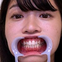 【歯フェチ】八森わか菜ちゃんの歯を観察しました!