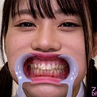 【歯フェチ】天沢りんちゃんの歯を観察しました!