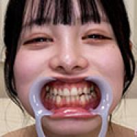 【歯フェチ】月見若葉ちゃんの歯を観察しました!