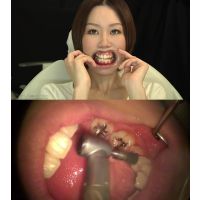 歯科医師映像　ねねちゃん