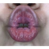 タコチューマニアックNo5〜童顔唇ことちゃんPart�　� 