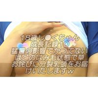 18歳し●くちゃん成長記録10猛暑の影響で衣装からのはみ毛がお見苦しくて申し訳ございませんwお詫びに分裂乳頭をお届けいたしますw