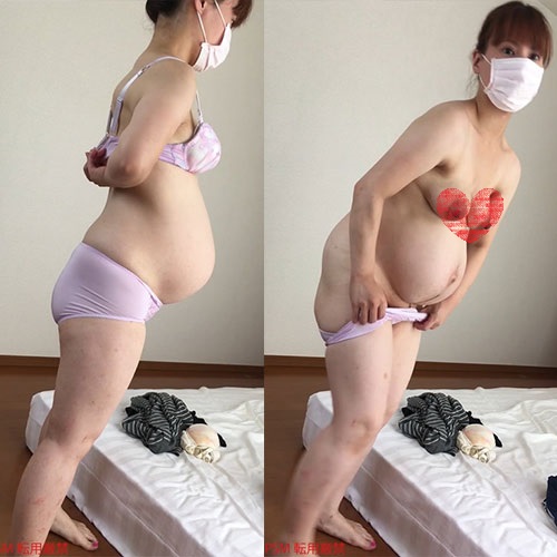 【全裸キター！グロ乳首！妊婦着替え盗撮】ボテ腹パイパンに帝王切開！！ gallery photo 1