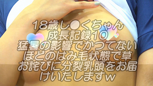 Gcolle 18歳し●くちゃん成長記録10猛暑の影響で衣装からのはみ毛がお見苦しくて申し訳ございませんｗお詫びに分裂乳頭をお届けいたしますｗ 984499
