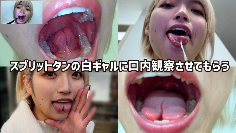 Gcolle 街角で声をかけて口内観察させてもらう 美容部員 はるのちゃん nko05-1 993616