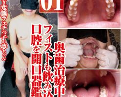 Gcolle PPV 979261 潮吹き変態の夢ちゃん奥歯治療中!?フィストも飲み込む口腔開口器鑑賞