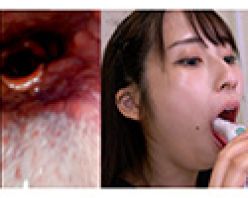 Gcolle PPV 993229 【歯フェチ】特別企画！ 真白みのりさんの歯・口内・喉奥を歯科用カメラで観察