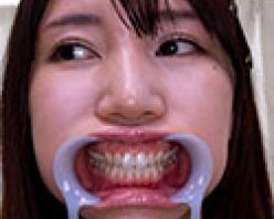 Gcolle PPV 985824 【歯フェチ】美丘さとみさんの歯を観察しました！