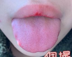 Gcolle PPV 732182 【個人撮影】（※注）巨根女（喉ちんこ）の口内を観察してみたら虫歯・ヤニ・巨大喉ちんこと逸材だった！　あんり【Y-077】