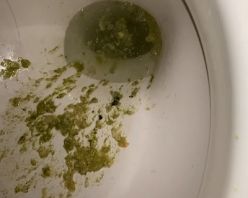 Gcolle PPV 973178 ゲロ-2 Gcolle PPV 973178 ゲロ-2